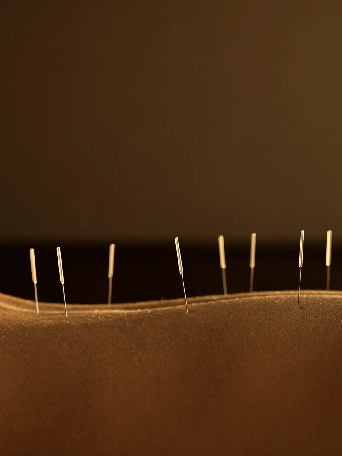 Traditional Chinese Acupuncture at ReGlow Wellness in Levittown, NY